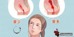 试管容易怀双胞胎吗？