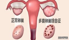 泰国试管婴儿需要做什么