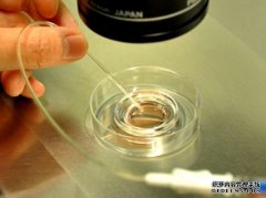 精子不液化怎么办?