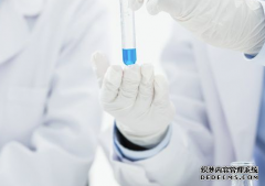 爱之晶：月经不调该怎么检查，对试管有影响吗