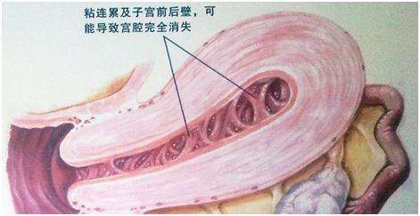 深圳试管婴儿中心