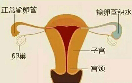 女性输卵管
