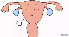 Hello IVF：子宫畸形的女性可以做试管吗？